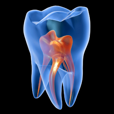 cavities Gentle Dental Center